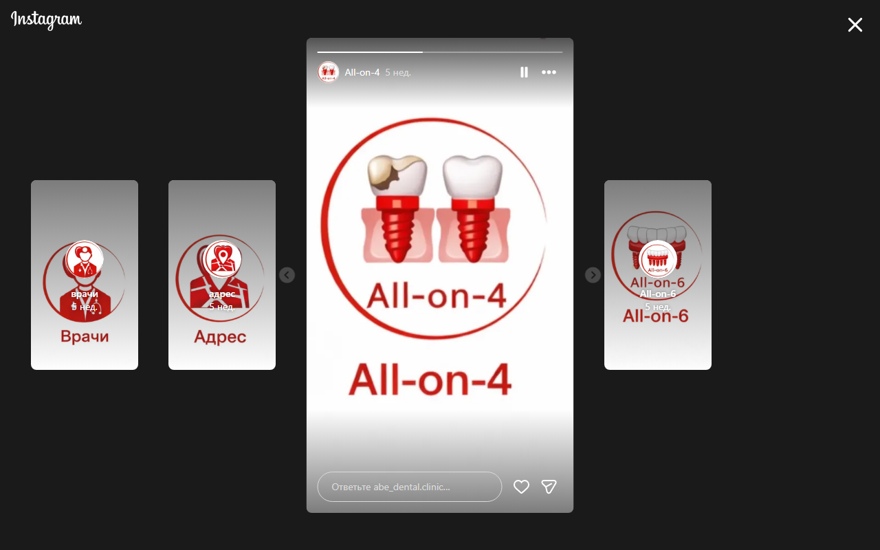 All-on-4 протезирование