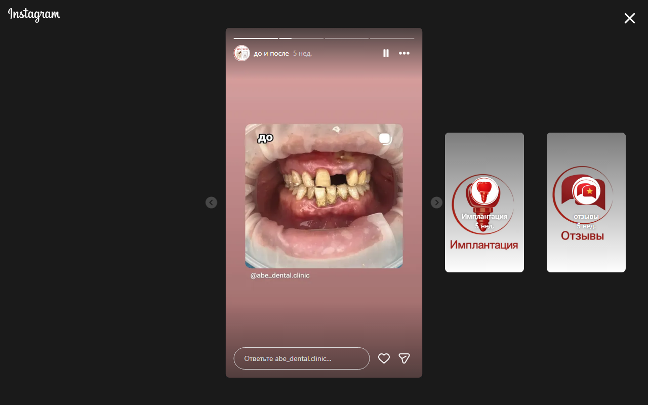 До лечения — пациент 1