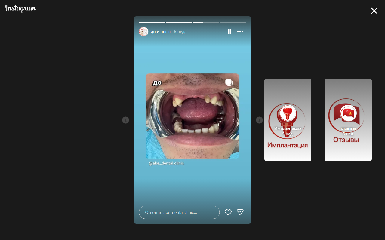 До лечения — пациент 2