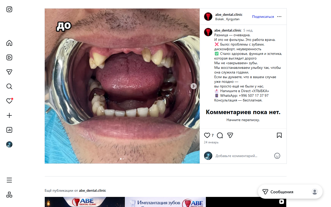 Кейс до имплантации