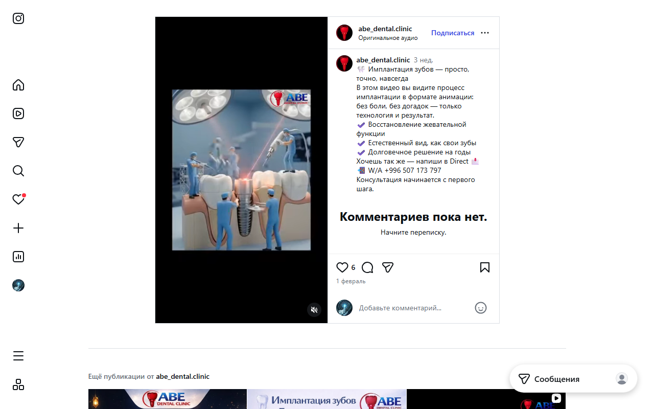 Имплантация зубов