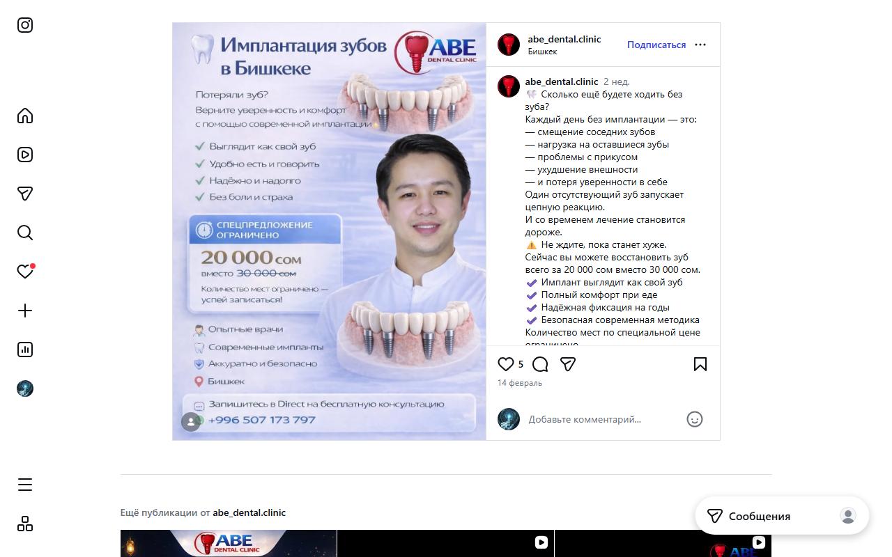 ABE Dental Clinic — результат имплантации