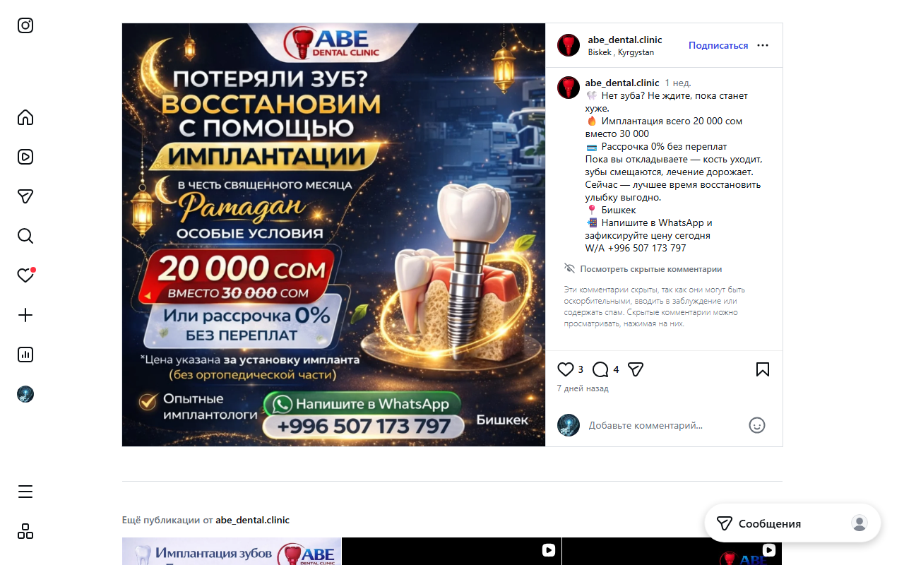 Лечение зубов